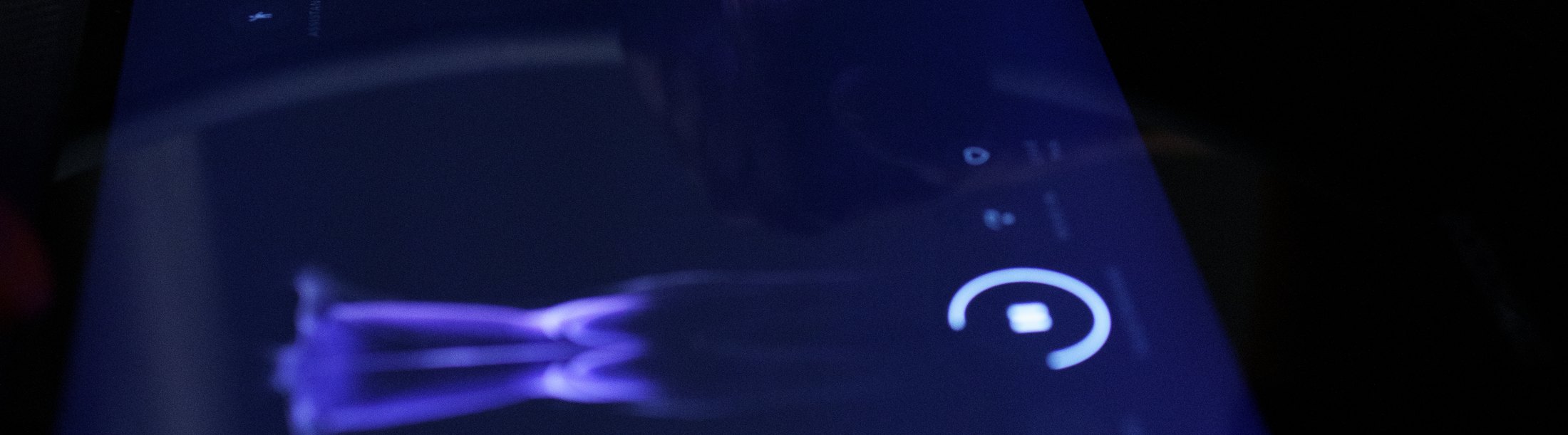 A body scan rendered on the Aescape table’s in-session display